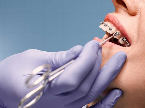 Dental Care Treatment Complete Guide to Oral Health and Preventive Care