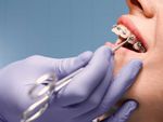 Dental Care Treatment Complete Guide to Oral Health and Preventive Care